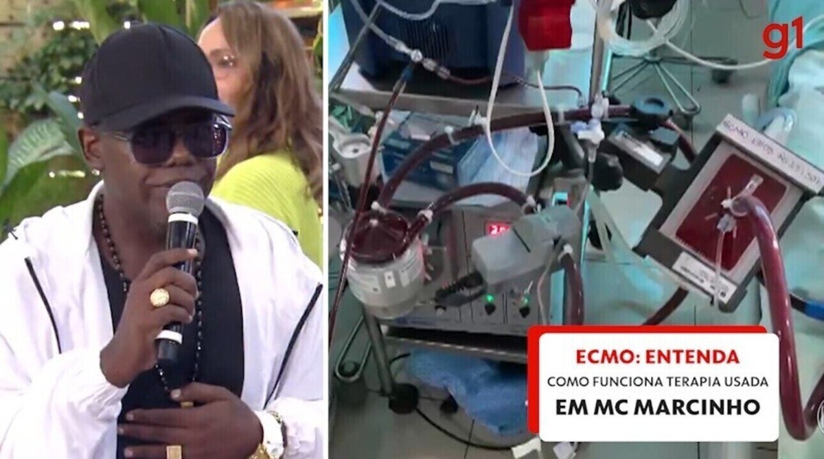 MC Marcinho usa terapia conhecida como ECMO, espécie de pulmão artificial; entenda como funciona